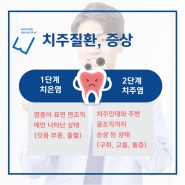 서면치과, 워너비가 알려드리는 치주질환 증상과 치료