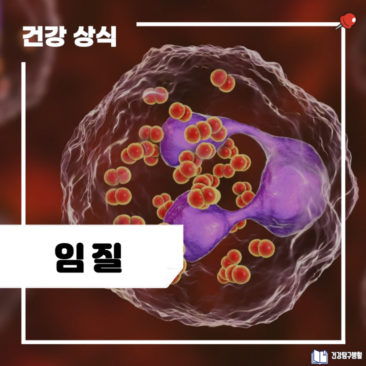 임질 증상 및 원인과 치료 방법 : 여자, 남자 : 네이버 블로그