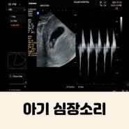6W3D : 아기 심장소리 (Feat. 쭈꾸미 태몽)