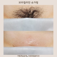 부산 서면 브라질리언 슈가링 왁싱 하시려면 안전한 끌레오 슈가링 트윈토탈뷰티크 에서 받아보세요!