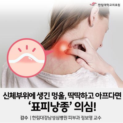 신체 부위에 생긴 멍울이 딱딱하고 아프다면 '표피낭종'을 의심하세요 : 네이버 블로그