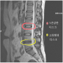 구리 일요일 한의원 - 허리 mri 해석하는 법