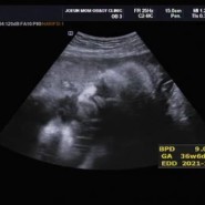 임신일기 37주 : 임신 막달 초음파 , 막달 아기 몸무게