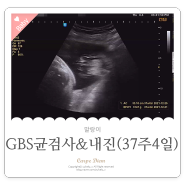 미아 햇빛병원 GBS 균검사 & 내진 (37주4일)