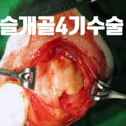 11살 포메라니언 슬개골 내측탈구 4기 수술(대구,다사,달성군,달서구 동물병원)