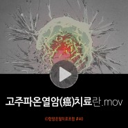 [영상] 고주파온열암치료 알아보기06 - 고주파온열암치료란