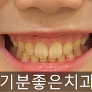 [부천상동치과/교정치과/치아교정/상동역치과] 치아교정도 기분좋은치과에서 하세요