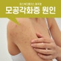 팔 피부 오돌토돌 모공각화증 원인과 예방법