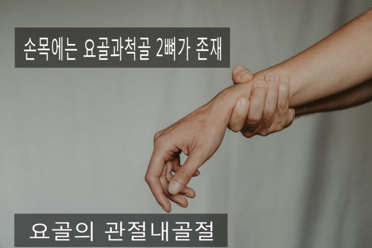 요골 원위부 골절 (손목골절) 사례 : 네이버 블로그