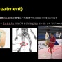 <무릎내측통증>거위발 건병증(pes anserinus)