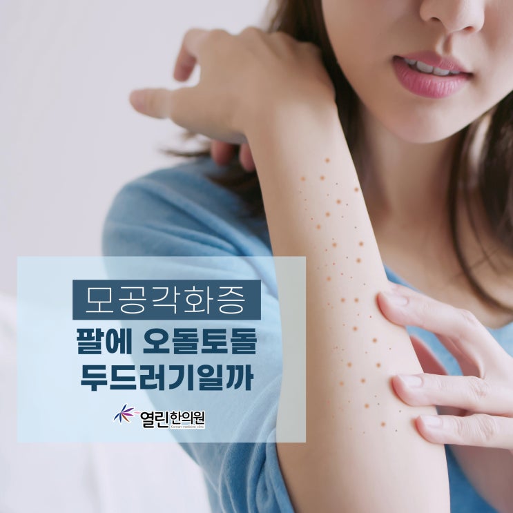 모공각화증 팔에 오돌토돌 두드러기일까 : 네이버 블로그