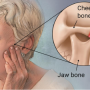 턱관절 질환과 관련된 증상들. 턱관절 장애. 상일동역 치과