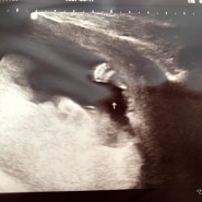 [22.02.24 - 04.03] 임신 16-21주 그리고 임산부 코로나 확진