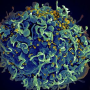 희망적인 mRNA HIV 백신