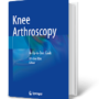 Knee Arthroscopy: An Up-To-Date Guide