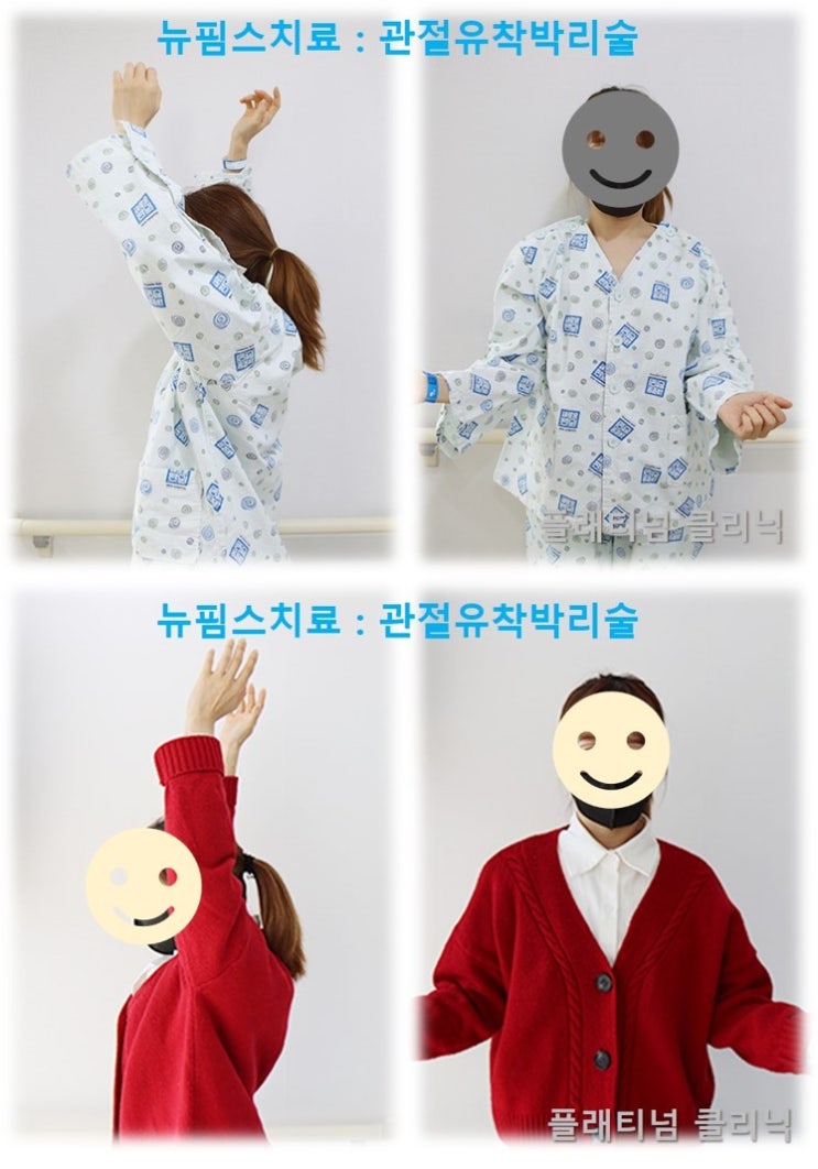 (플래티넘클리닉) 오십견, 어깨 유착성관절낭염 방치하지 말고 빠르게 회복합시다!