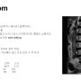 극외측 디스크 탈출증(far lateral disc herniation)의 수술치료 / 동래 온천장 부산 우리들병원