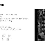 극외측 디스크 탈출증(far lateral disc herniation)의 수술치료 / 동래 온천장 부산 우리들병원