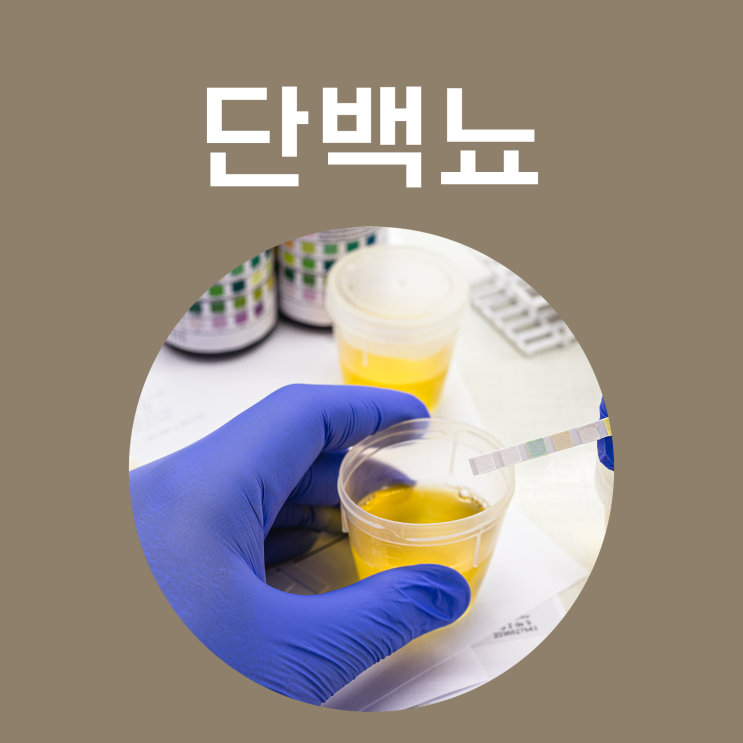 단백뇨 증상 원인 치료 요단백 아침 소변 거품 거품뇨 콩팥이 안좋으면 눈이 붓는 이유 : 네이버 블로그