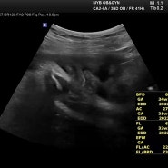 [임신 일기] 임신34주차 막달검사(혈액검사, 소변검사, 심전도, X-ray)
