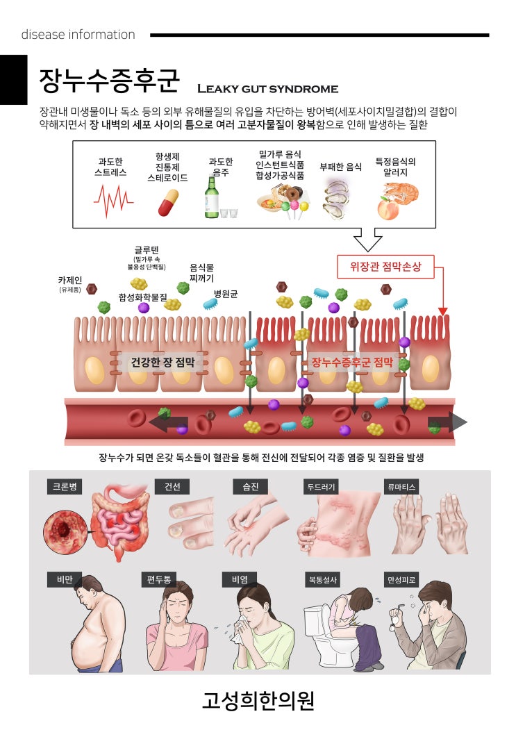 [장누수증후군] 장 건강 디톡스로 만성 염증 줄이기 : 네이버 블로그