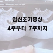 임신초기증상 4주부터 7주까지! 임산부고열 감기 타이레놀,입덧! 둘째 임신 산전검사