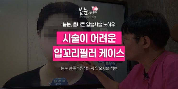 입꼬리필러로 처진 입꼬리를 올리기 어려운 케이스(ㅅ자 입술 입매교정) : 네이버 블로그