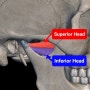 Lateral Pterygoid (외측익돌근 / 익상근, 가쪽날개근) : 턱관절 장애(TMD)