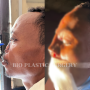 BIO비아이오성형외과 ‘신용호원장’ 에티오피아 코재건수술