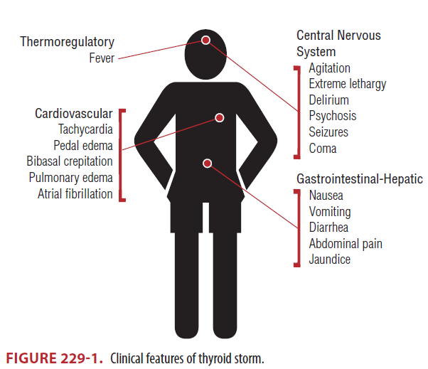 Hyperthyroidism(갑상선기능항진증), Thyroid storm(갑상선폭풍) : 네이버 블로그