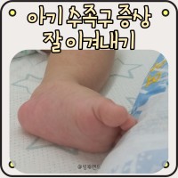 6개월 아기 수족구 증상 (고열 수포 음식) 섬네일