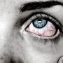 눈 핏줄터짐 눈충혈 원인 건조할때 심해질 수 있어요!