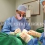 고도안검하수를 교정하는 CFS(공통근막)수술