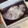 임신 4-5주차 / 임테기 두 줄+초음파 검사+산모 수첩