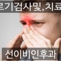 중랑구- 알레르기 검사 후 치료, 방법