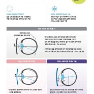 근시진행완화 눈이 덜나빠지게 하는 안경렌즈 드림렌즈 칼자이스 마이오비전 원시성흐림 근시성흐림