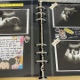 [시험관 임신 37주] 강남차병원 막달 정기초음파 & 머리 큰 아기