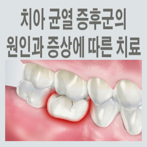 균열에 빠진 아이