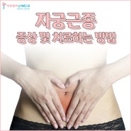 양산자궁근종 증상 및 치료하는방법