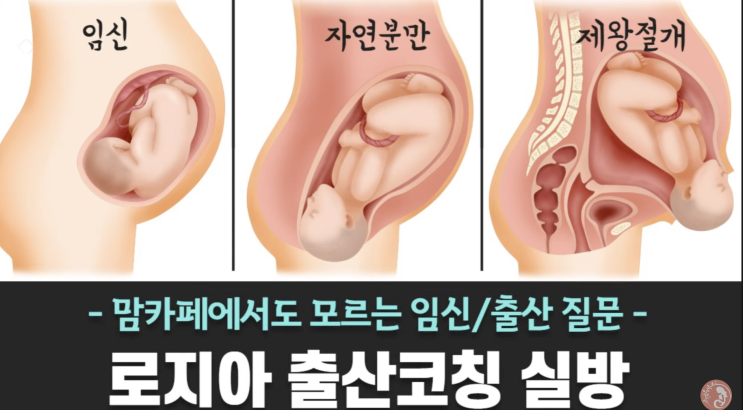 자연분만과 제왕절개의 장단점, 첫출산이라면 무엇을 선택할까?