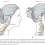 전방머리자세 환자의 목뼈 관절가동술 치료