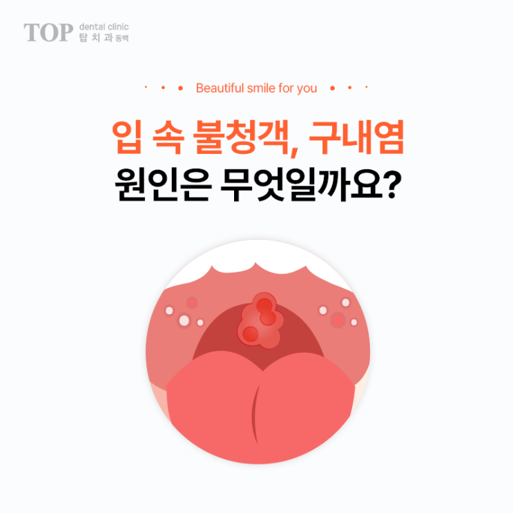 입 속 불청객, 구내염의 원인은 무엇일까요? : 네이버 블로그