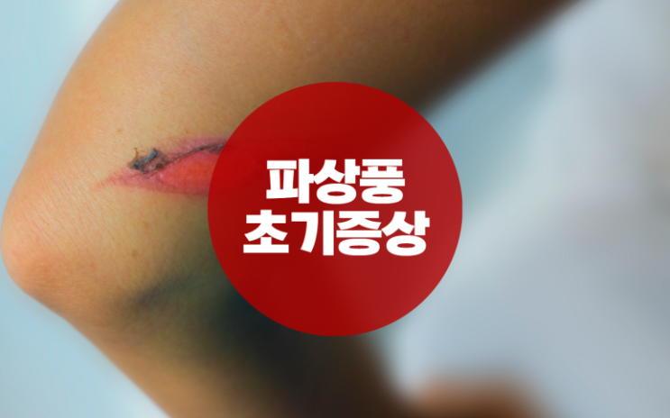 파상풍균이 번식과 함께 생산해내는 신경독소 : 네이버 블로그