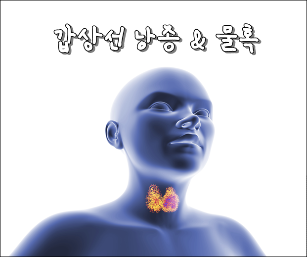 갑상선 낭종 & 목에 물혹 : 원인 및 제거 대처법 [정보총정리] : 네이버 블로그