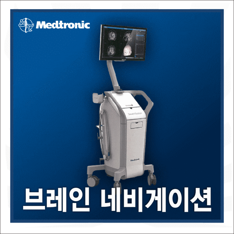 [제품소개] 브레인 네비게이션 (StealthStation™ S8) : 네이버 블로그