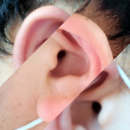귀 안쪽 가려움 원인이 무엇일까?