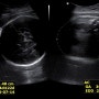 [셋째임신]: 36주3일 초음파 / 태아몸무게 / 초음파 / 막달검사