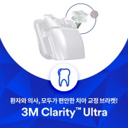 환자와 의사, 모두가 편안한 치아 교정 브라켓! 3M Clarity™ Ultra를 만나보세요!
