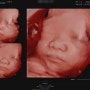 육아일기 : 임신 27주차, 입체초음파