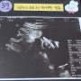 [시험관 임신 39주] 강남차병원 유도분만 결정& 강남구보건소 PCR 검사